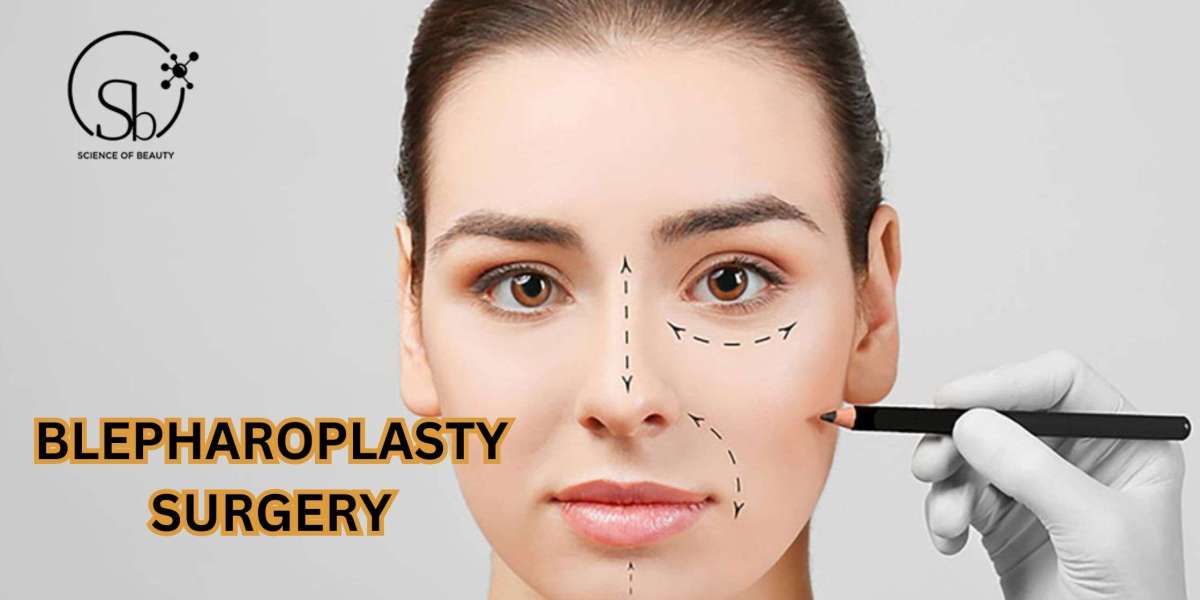 Why is blepharoplasty surgery becoming trending among females?