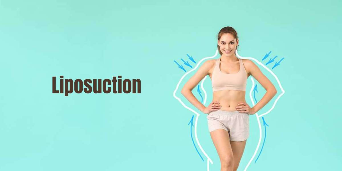 Debunking Common Myths About Liposuction