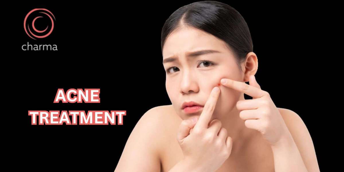 What is the Main Cause of Acne?