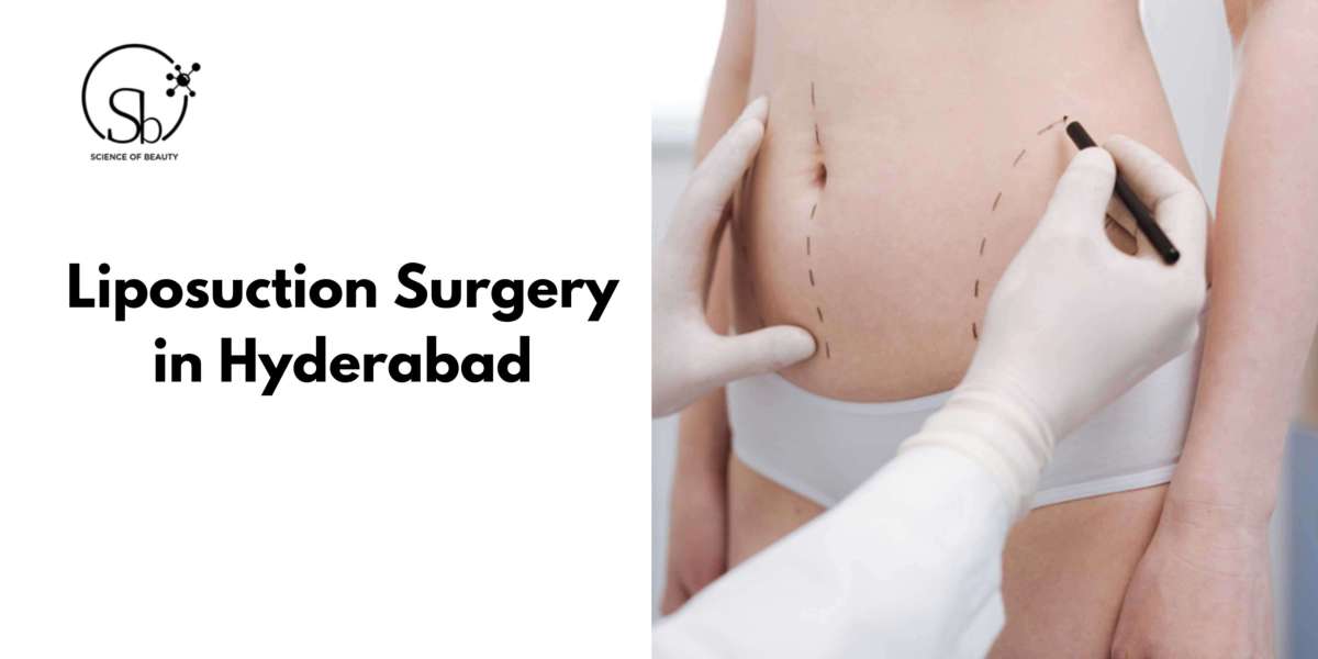What Body Areas Can Be Treated By Liposuction?