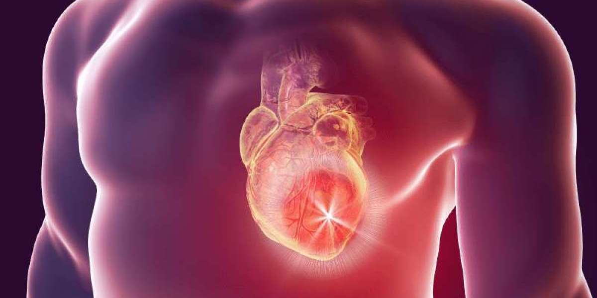 Heart Tumor Removal: A Delicate Balance