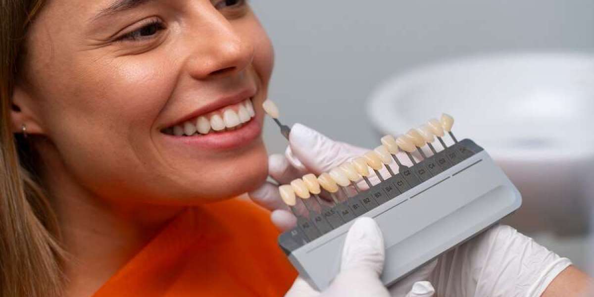 Invisalign Etobicoke: Your Guide to a Perfect Smile