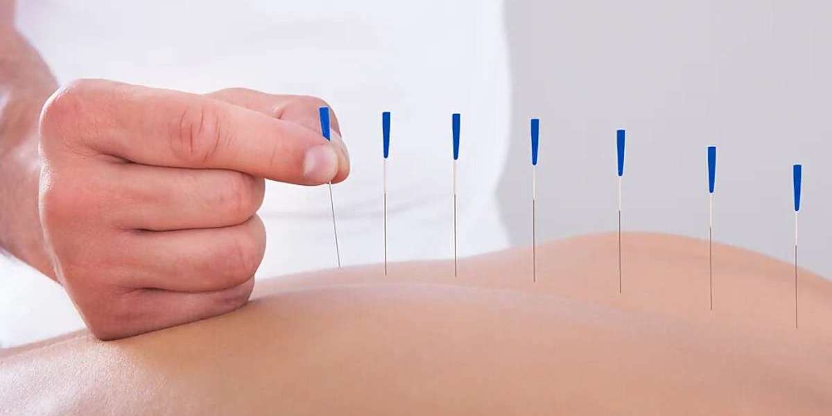 Electroacupuncture NYC