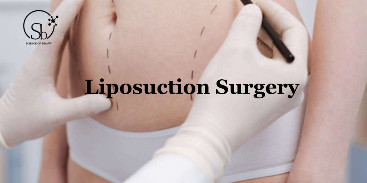 A Comprehensive Guide for Liposuction Surgery: That Covers All