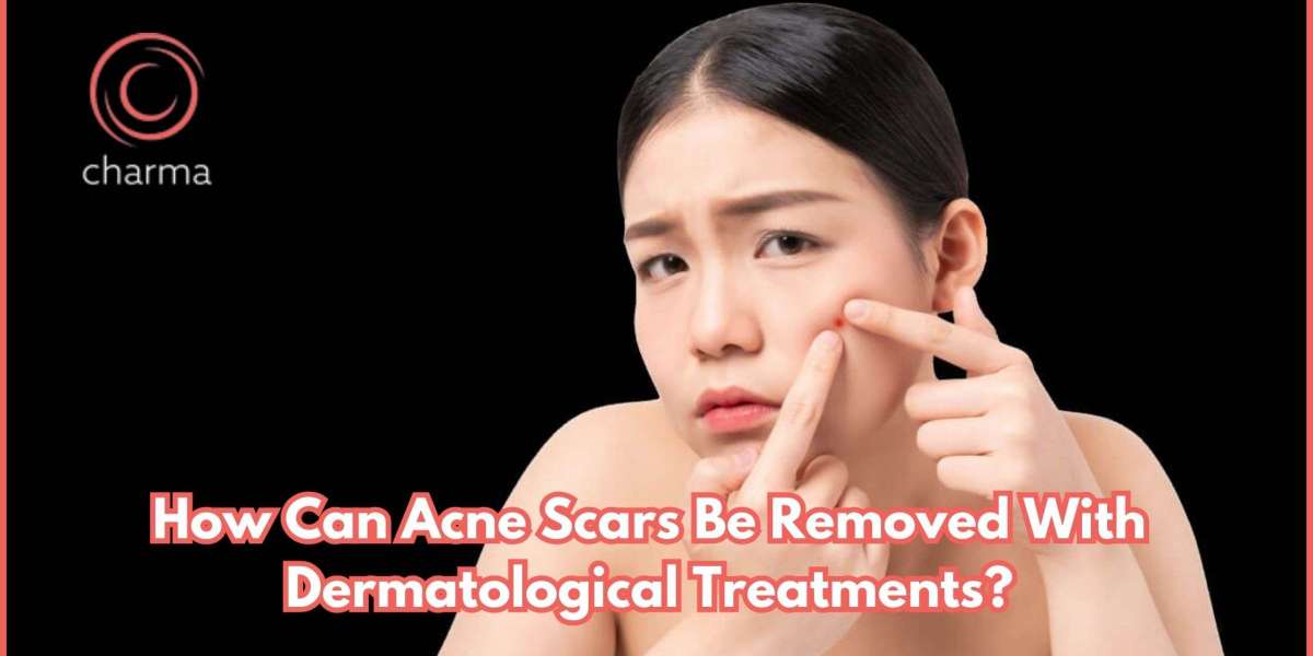 How can acne scars be removed with dermatological treatments?