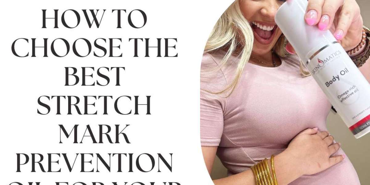 How to Choose the Best Stretch Mark Prevention Oil for Your Skin