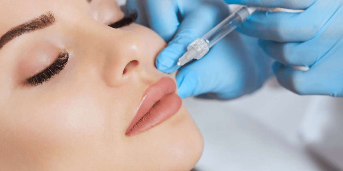 Lip Filler Trends in Dubai: What’s Hot Right Now?