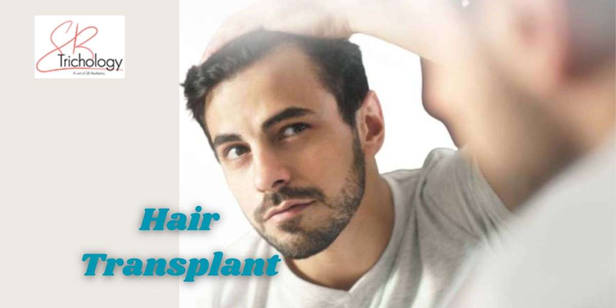 Hair Transplants and Bleeding: What Patients Should Know About Hair Transplant Surgery