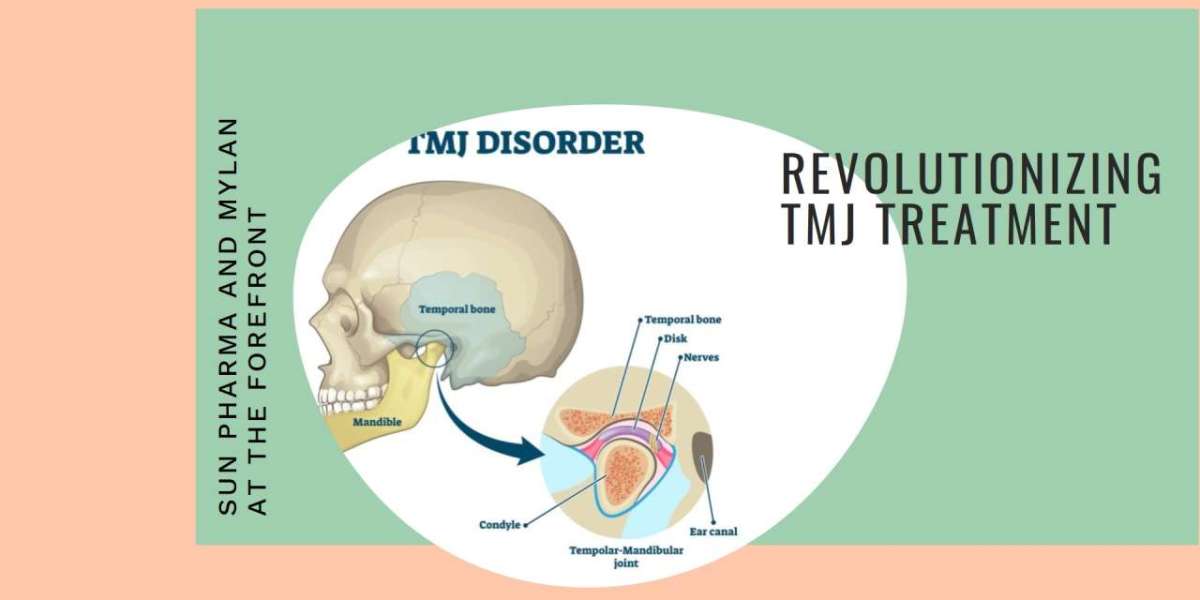 TMJ Disorder Breakthroughs: Sun Pharma, Mylan Leading the Way