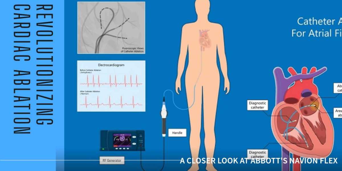 Cardiac Catheterization Revolution: Abbott, Edwards Lifesciences, and Medtronic Lead the Way