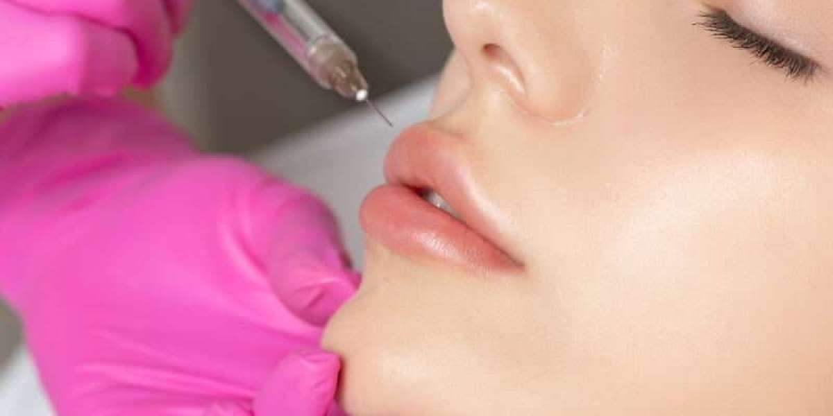 Botox Lip Flip in Dubai: Your Ticket to a More Youthful Appearance