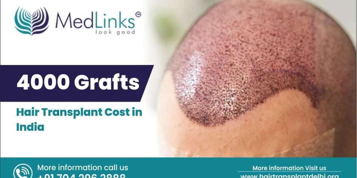 Hair Transplant Cost Per Graft in India 2024