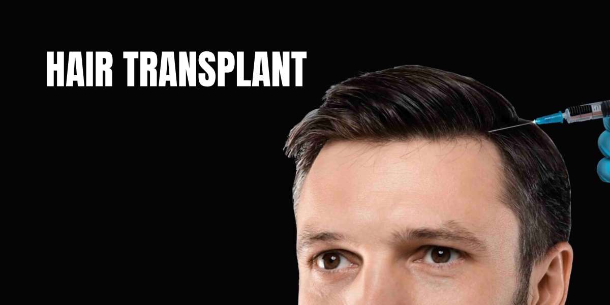 What to Avoid Before and After Hair Transplant Surgery?