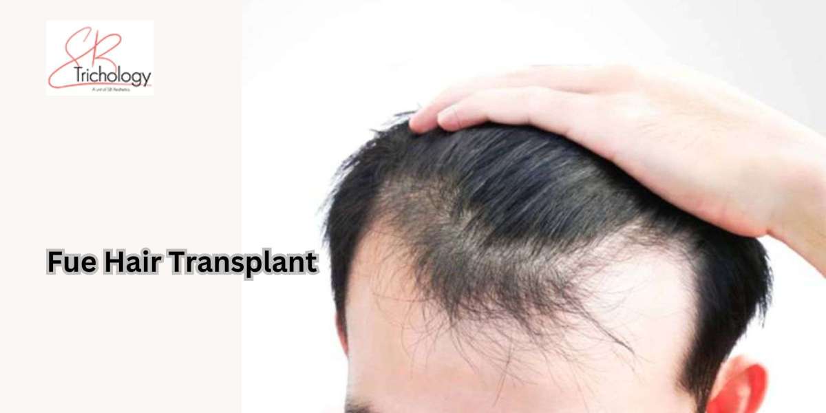 Why Are People Nowadays Choosing Fue Hair Transplants?