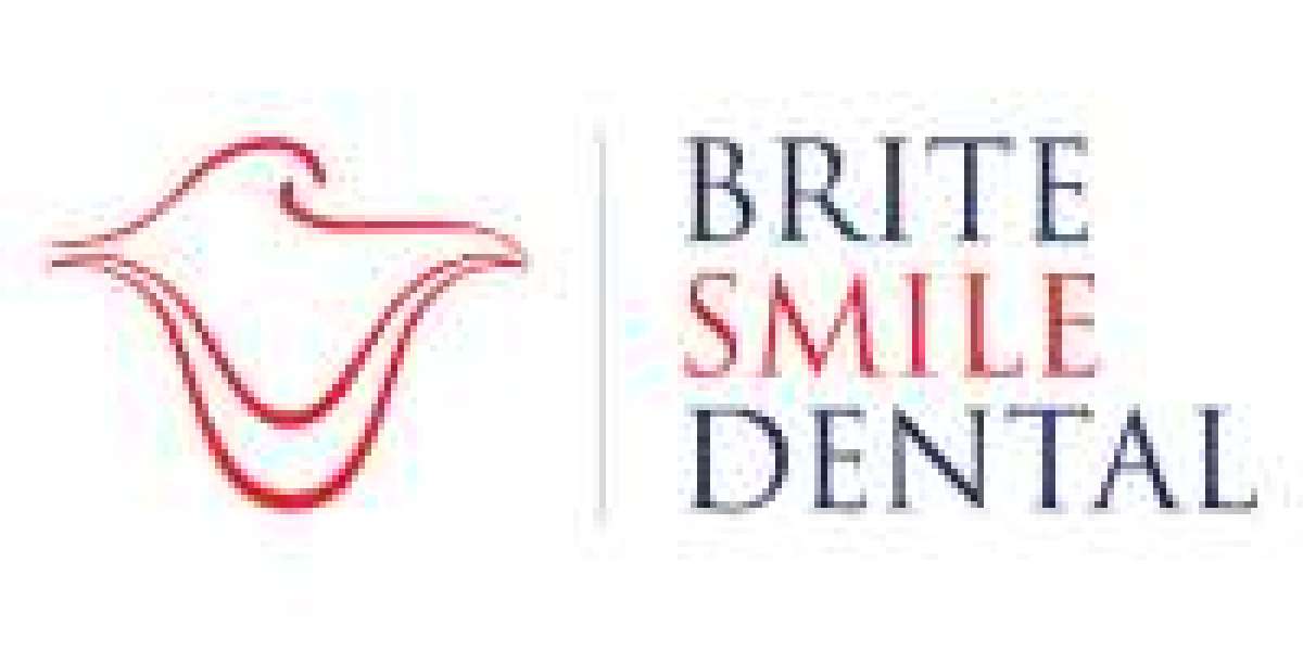 Transform Your Smile with Dental Veneers in San Diego | Brite Smile Dental