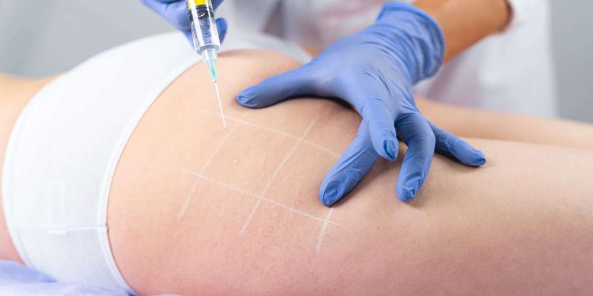 The Pros and Cons of Fat Melting Injections: Insights from Dubai Clinics