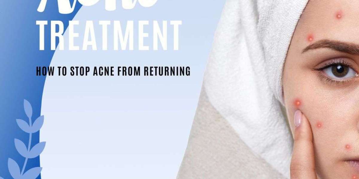 Achieving Clear Skin: The Ultimate Guide to Effective Acne Treatments