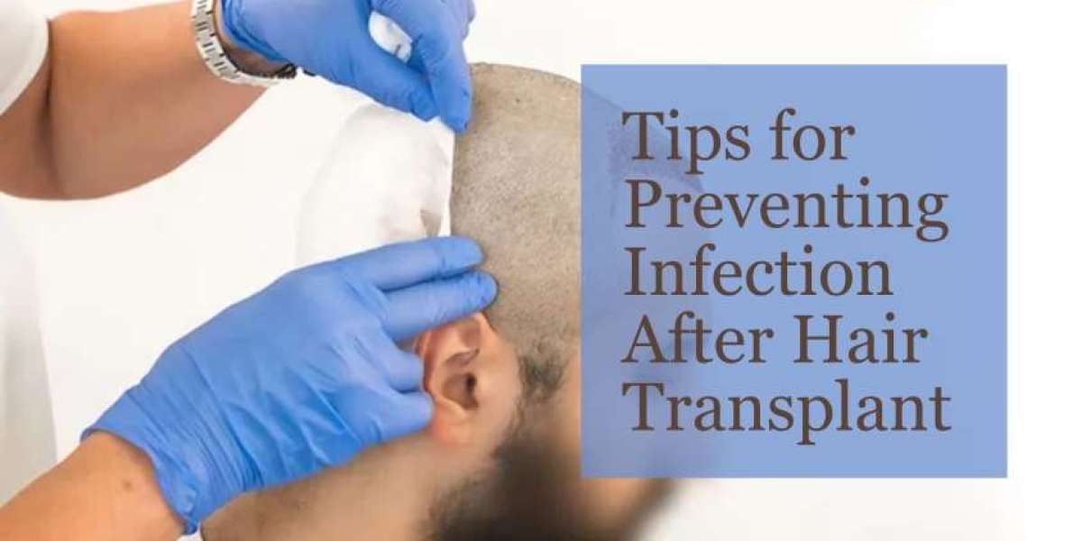 Tips for Preventing Infection After Hair Transplant