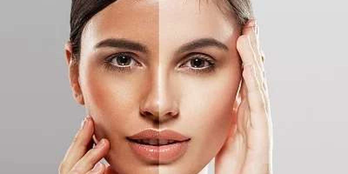 The Truth About Skin Whitening Treatments in Dubai: Results You Can Expect