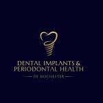 DENTAL IMPLANTS And PERIODONTAL HEALTH