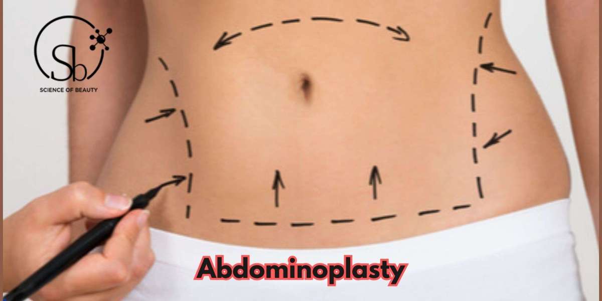 The Ultimate Benefits Of Abdominoplasty