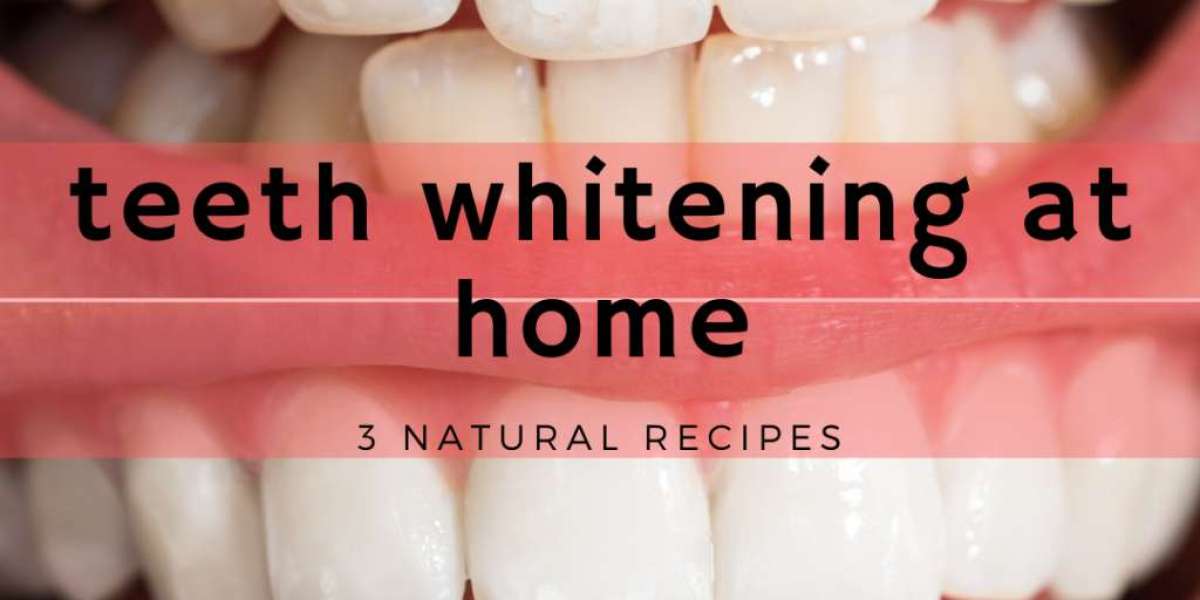 Crest Whitening