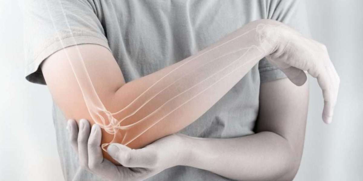 Stem Cell Therapy for Elbow Pain: How It Works and What to Expect