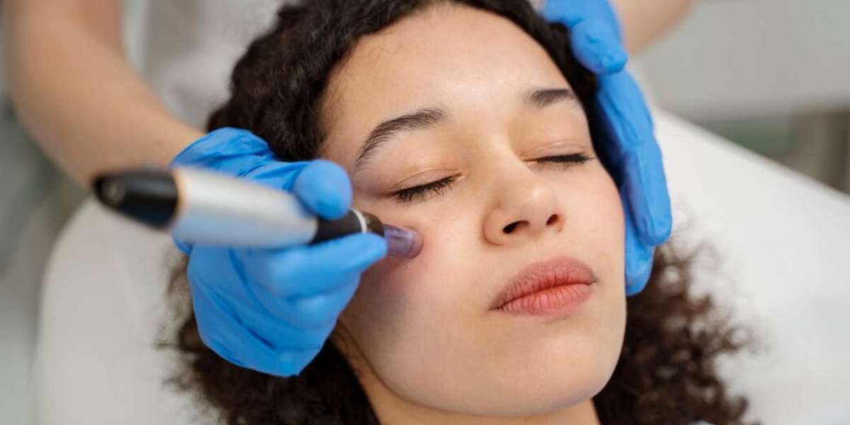 How Much Does Thermage Eyes Cost in Singapore?