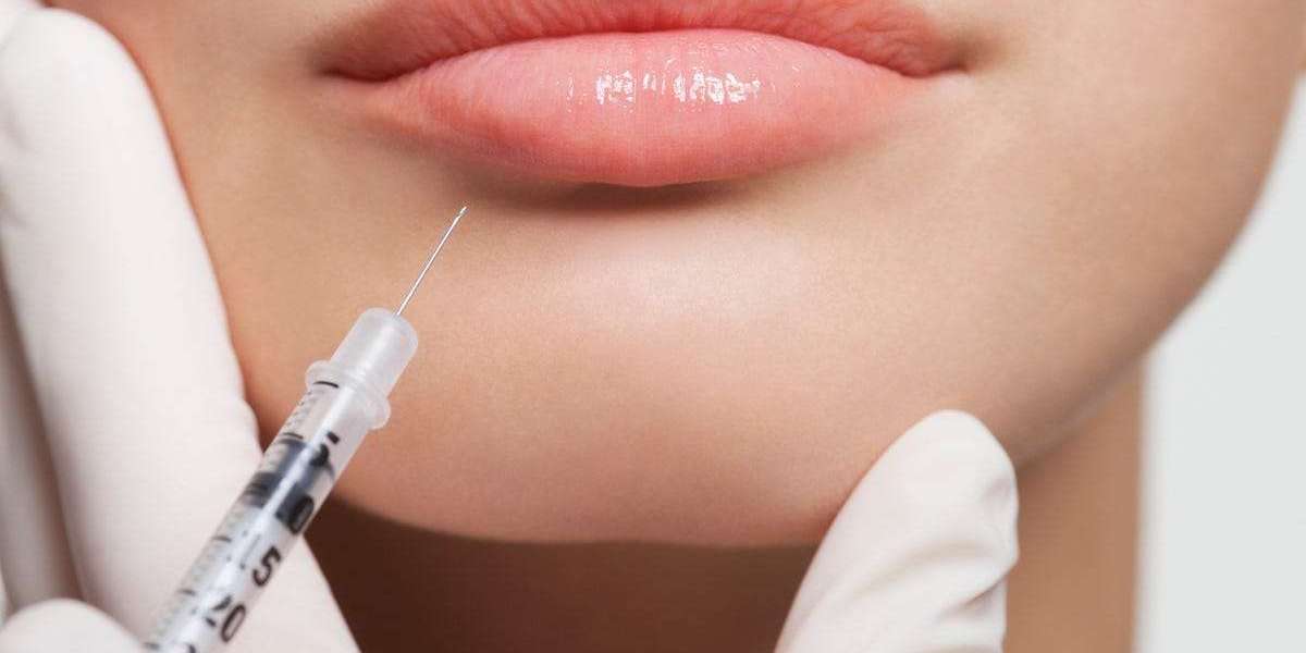 7 Key Factors That Affect the Price of Lip Fillers – What You Need to Know in 2024