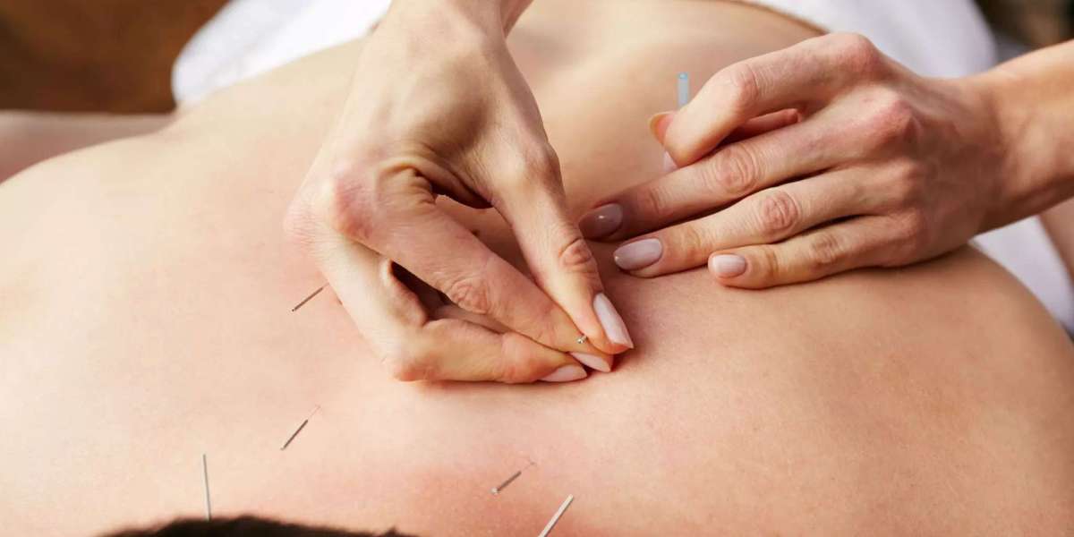 What Sets Philadelphia Acupuncture Clinics Apart?