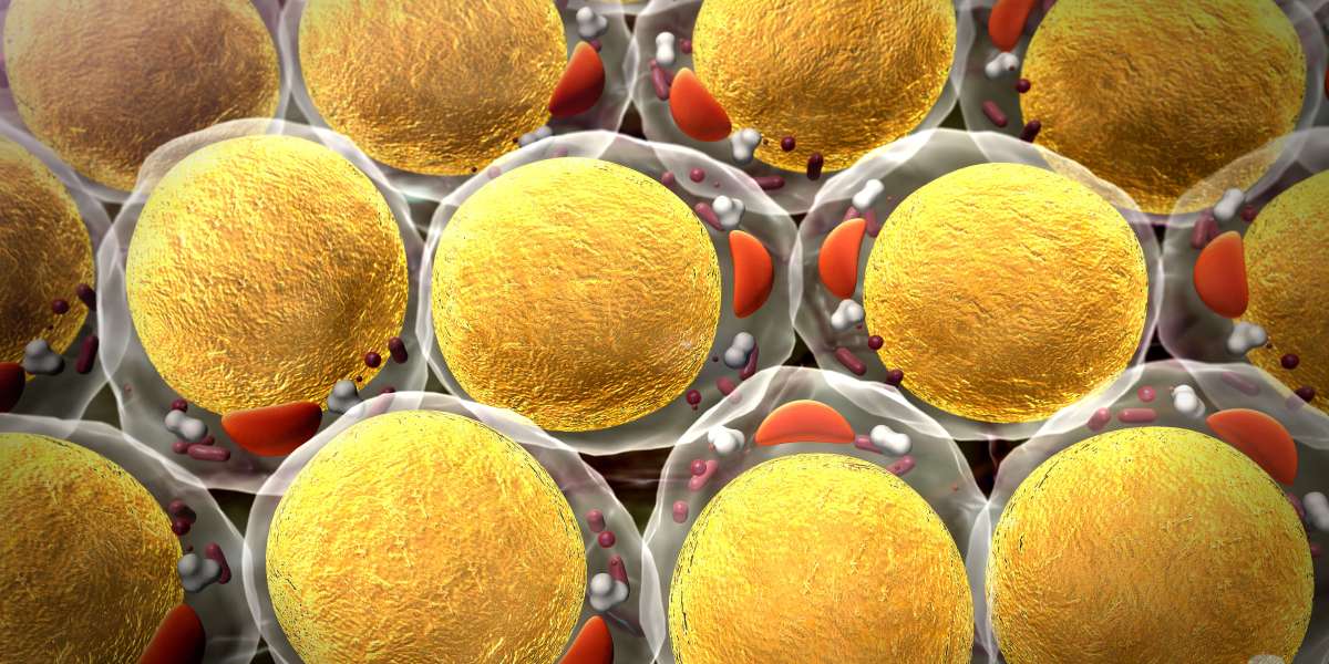 Understanding Label-Free Quantification Techniques in Proteomics