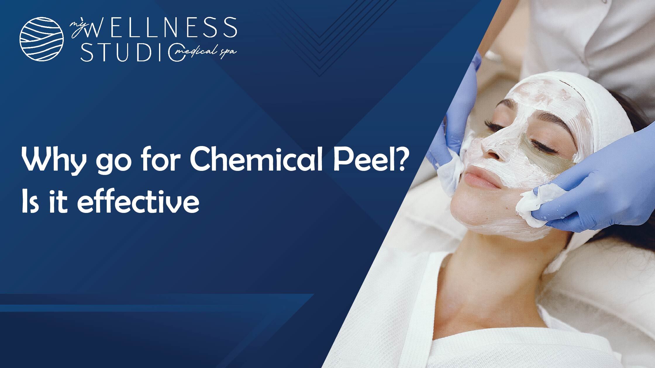 Why Go for a Chemical Peel? Benefits and Effectiveness Explained