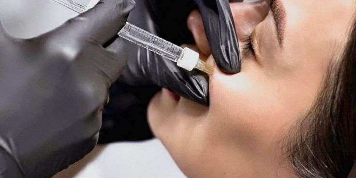 Enhance Your Beauty with Cheek Fillers in Dubai