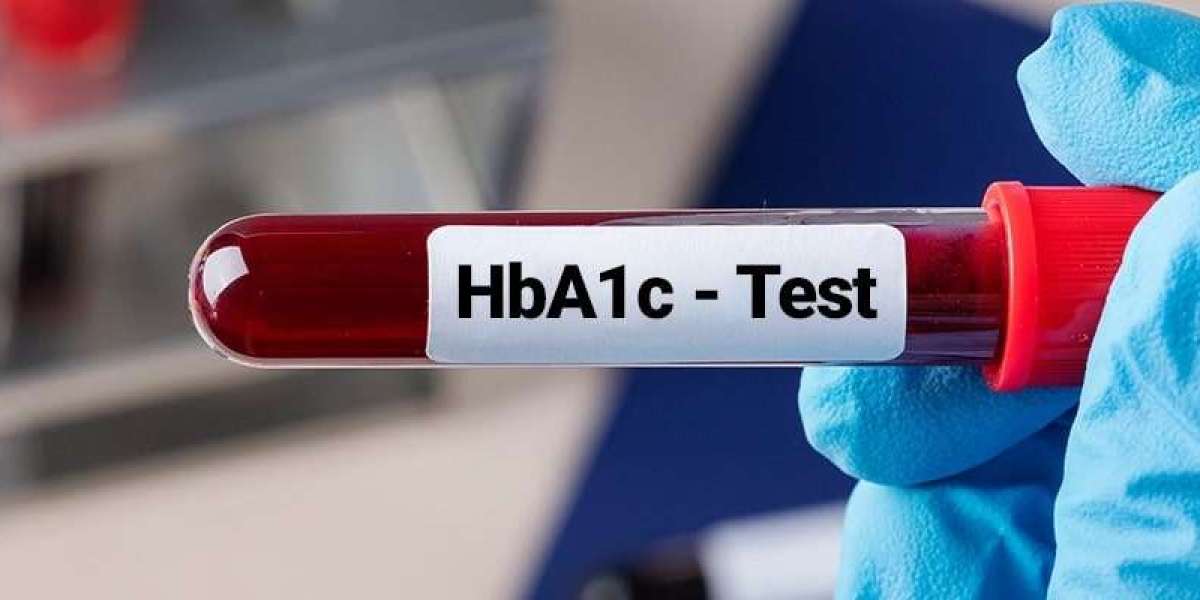 HbA1c Test: A Key to Managing Diabetes