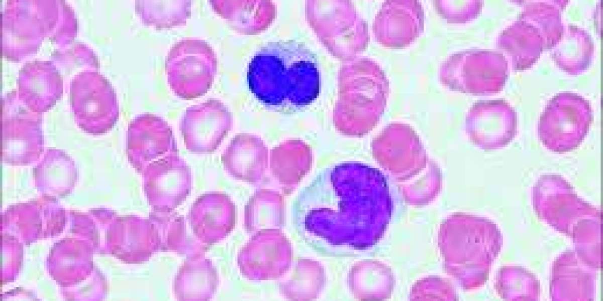 Thalassemia Market Size, Epidemiology, Industry Trends, Opportunity and Forecast 2024-2034