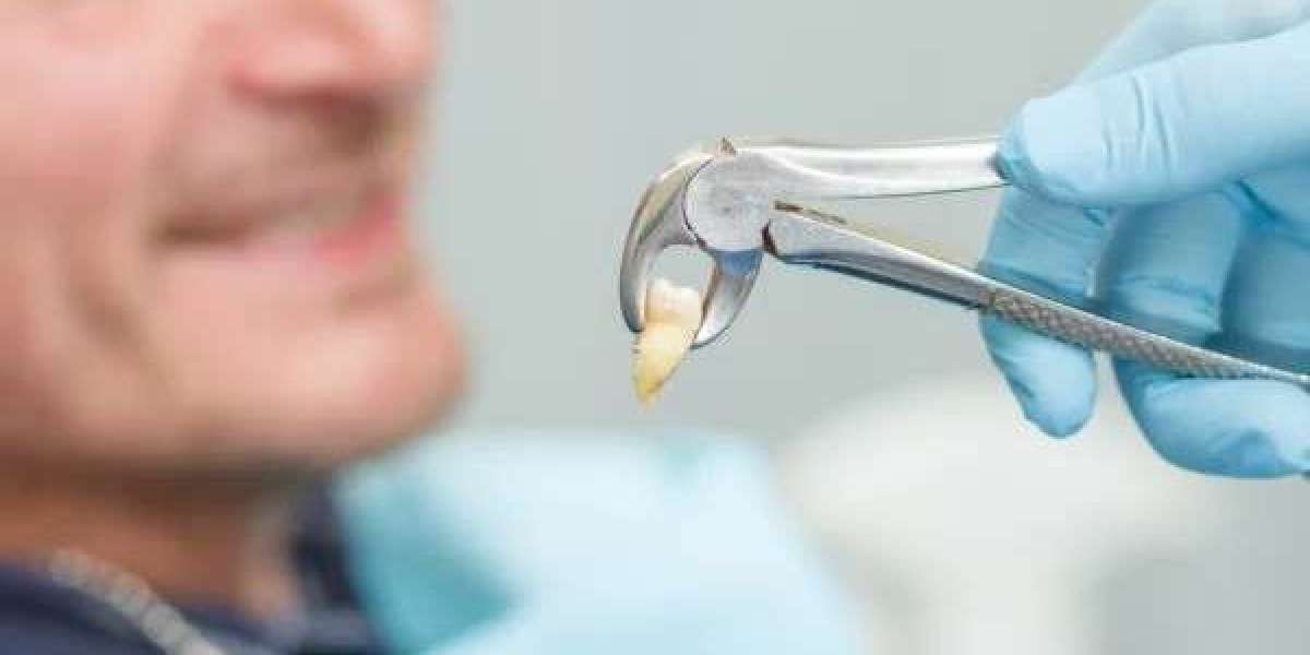 Affordable Tooth Extraction Services and Mobile Denture Solutions in Houston: