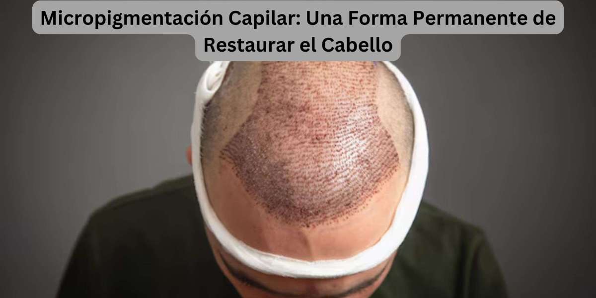 Micropigmentación Capilar: Una Forma Permanente de Restaurar el Cabello