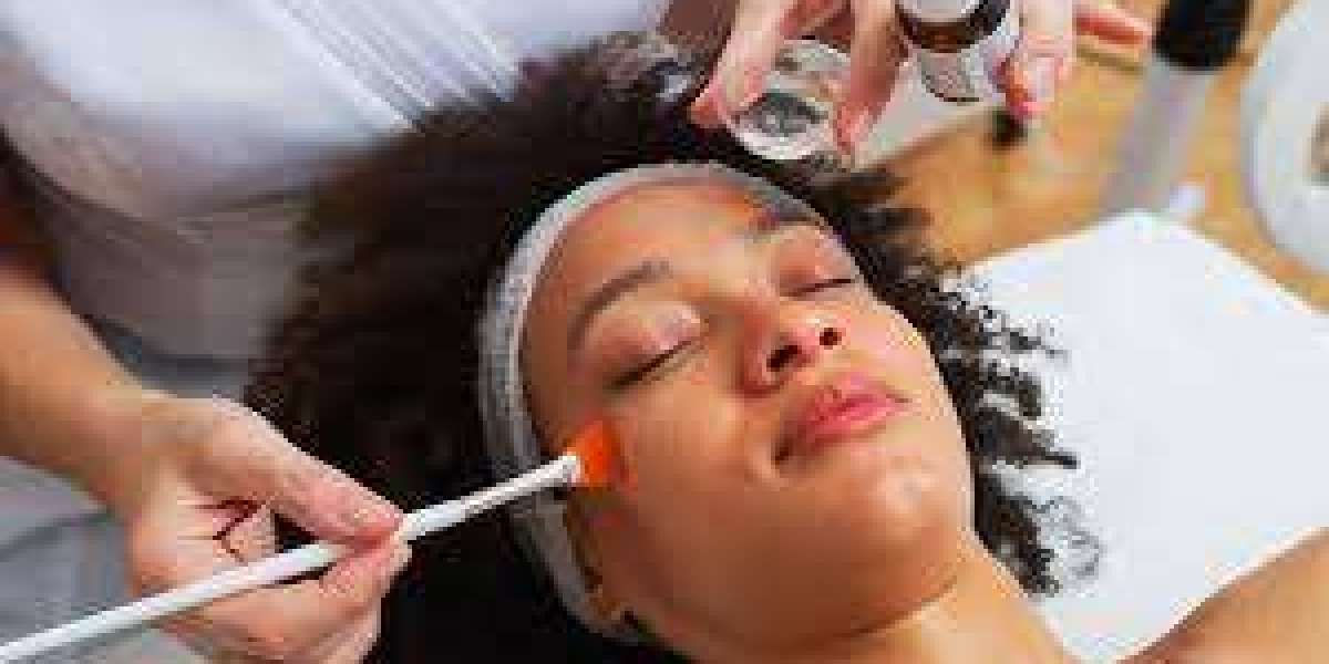 Chemical Peeling in Mumbai – Reveal Fresh & Radiant Skin