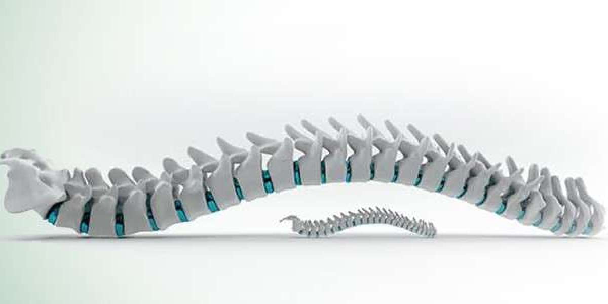 The Crucial Role of Physiotherapy in Spine Surgery Hospitals