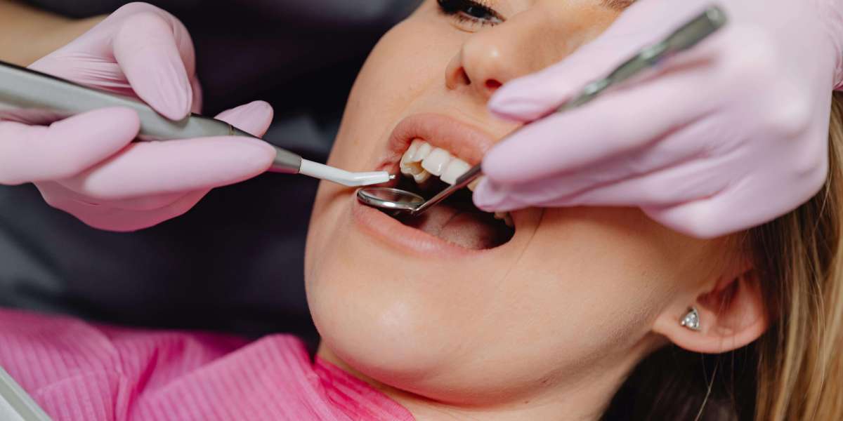 The Complete Guide to Dental Services: What You Need to Know