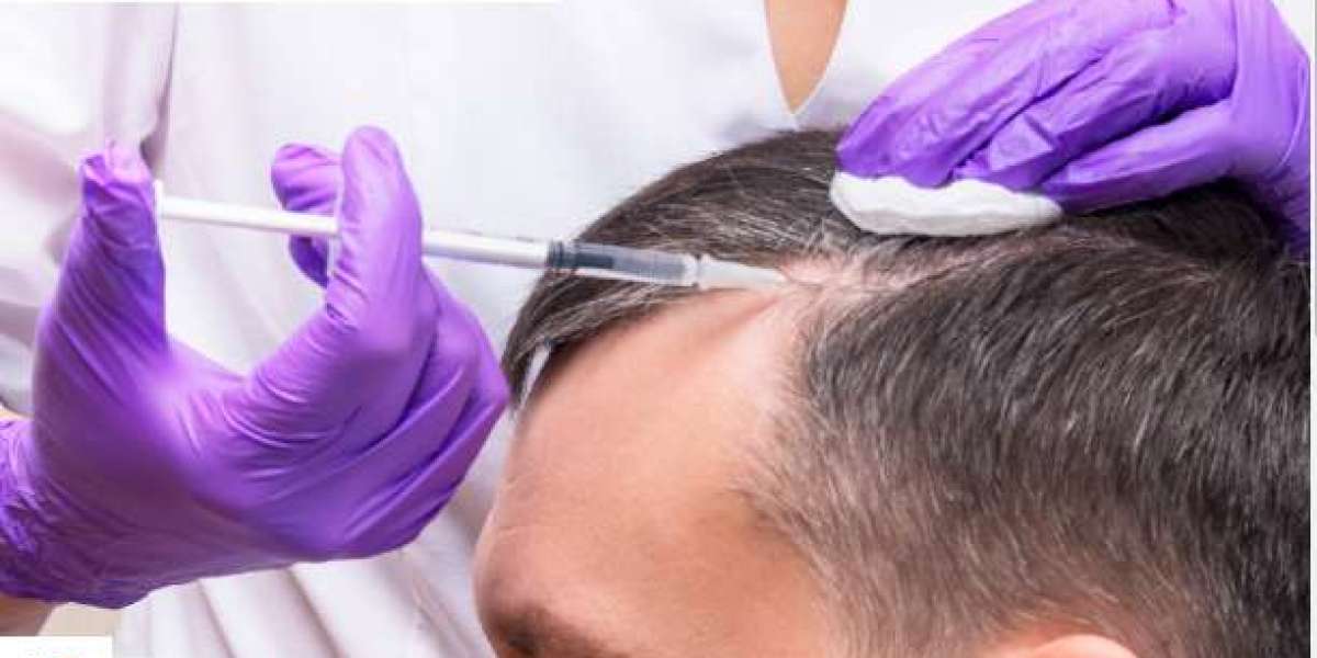 Alopecia Market Generated Opportunities, Future Scope 2024-2031 | Johnson & Johnson Services, Cipla, Merck KGaA