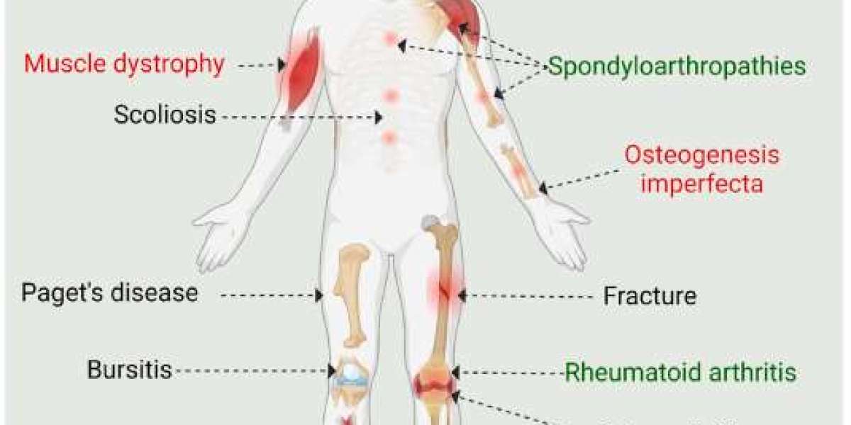 Relieve Pain: Integrated Care for Musculoskeletal Health