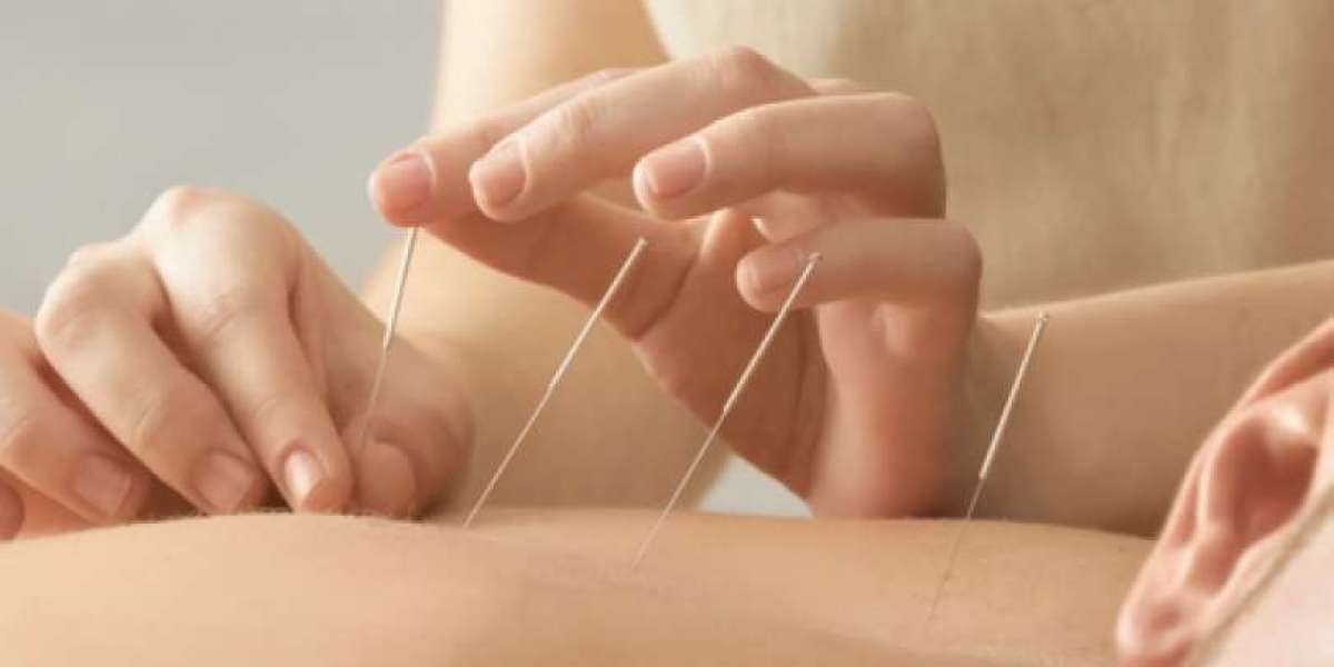 Why Acupuncture is Beneficial for Seniors